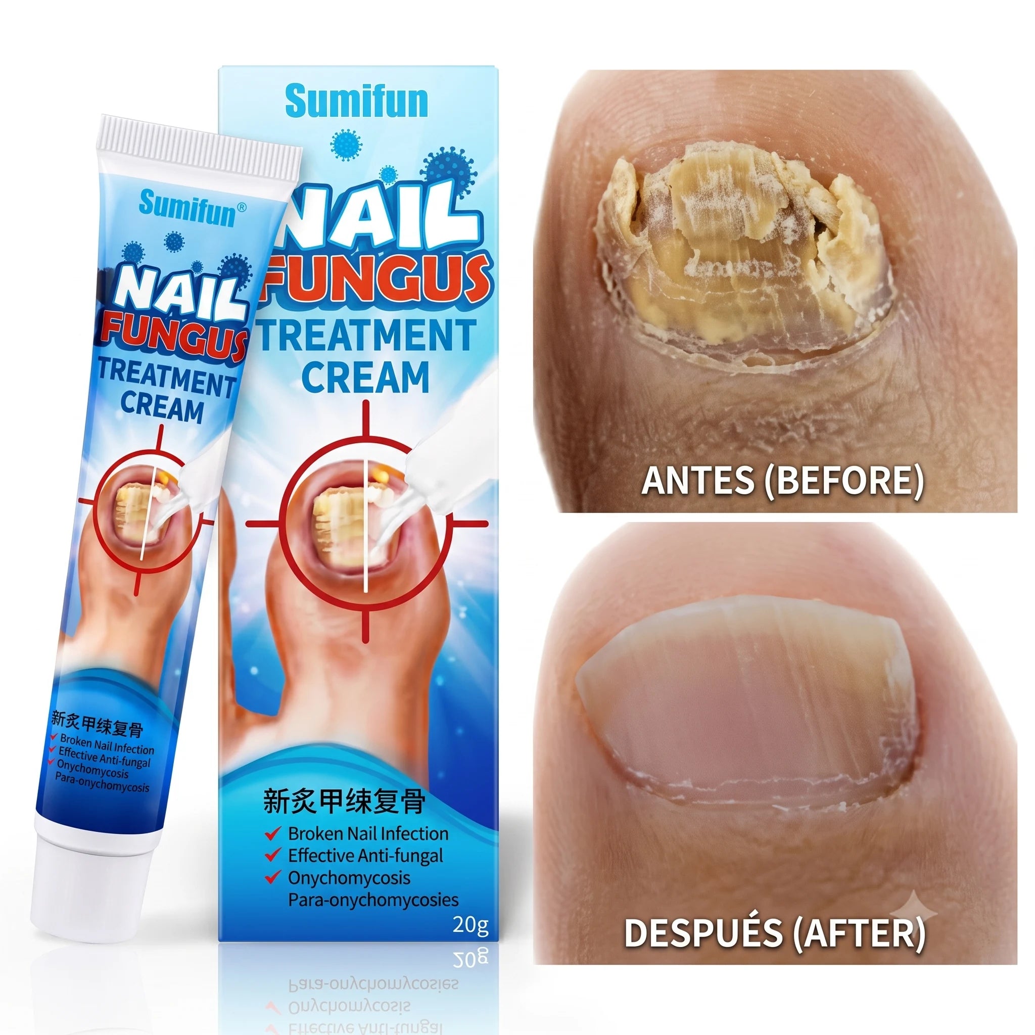 SUMIFUN FUNGICIDA PARA LAS UÑAS (20g)